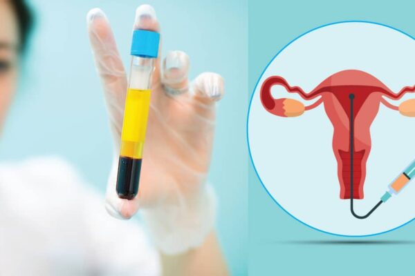 Endometrial PRP