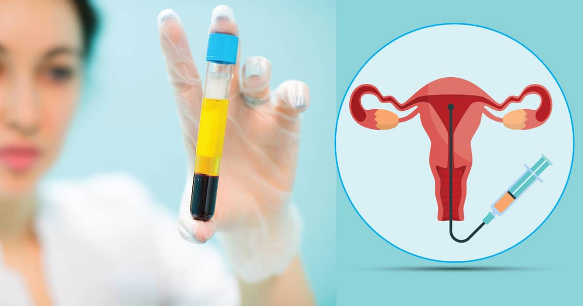 Endometrial PRP