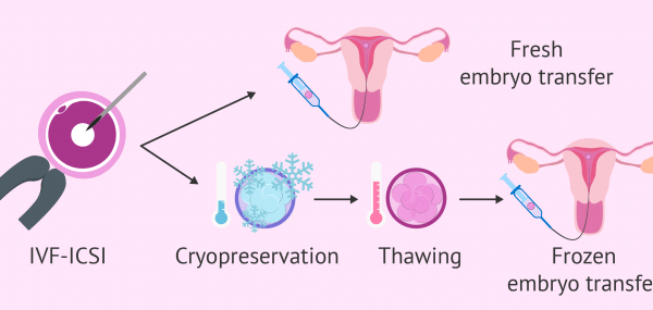Frozen Embryo Transfer (FET)