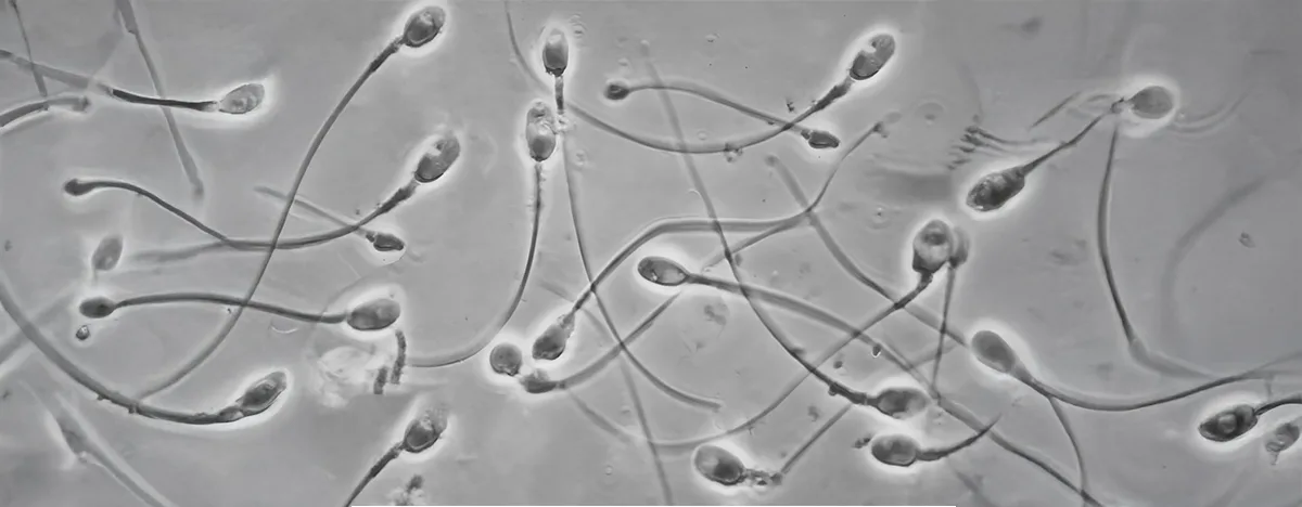 IMSI / PICSI — Advanced Sperm Selection