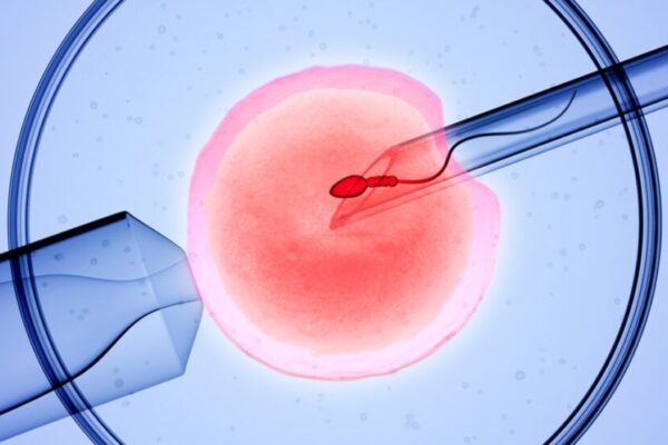 IVF Cost in Turkey 2026 — Istanbul Price Guide