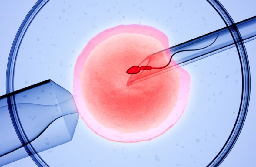 IVF Treatment