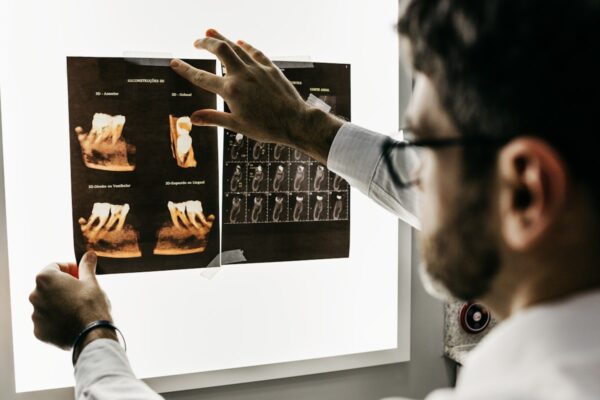 Menopause Assessment