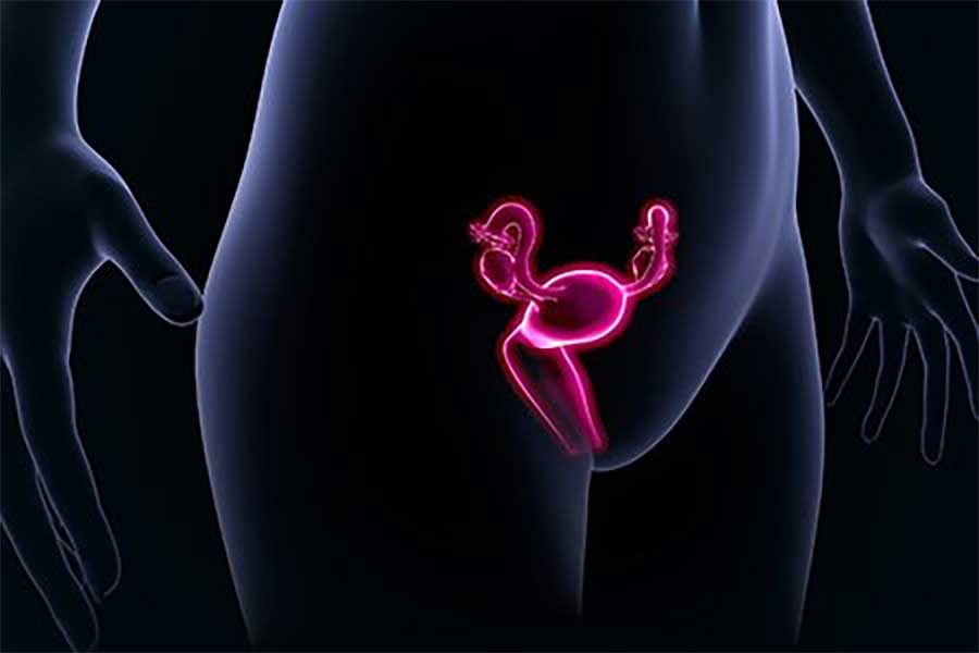 Prolapse