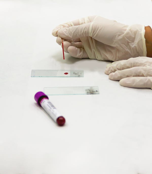 STD Screening