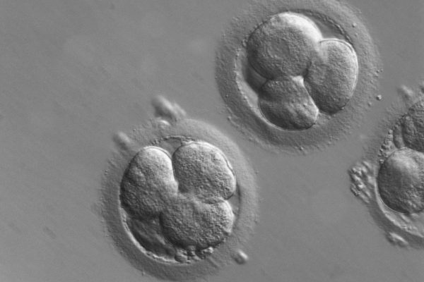 Embryo Biopsy (Preimplantation Genetic Testing)
