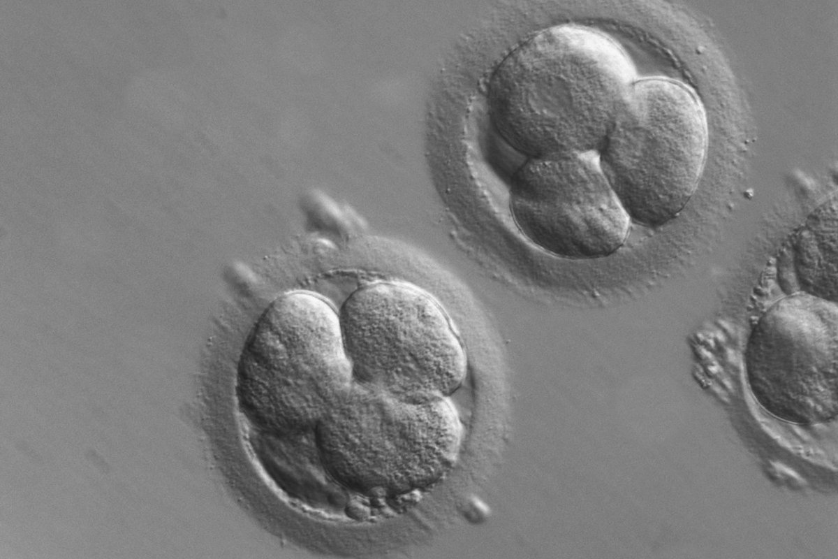 Embryo Biopsy (Preimplantation Genetic Testing)