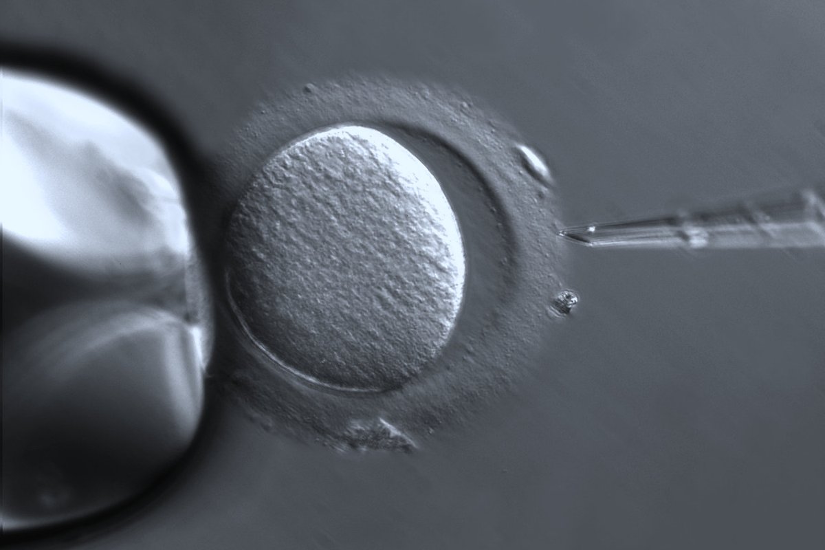 IVM – In Vitro Maturation